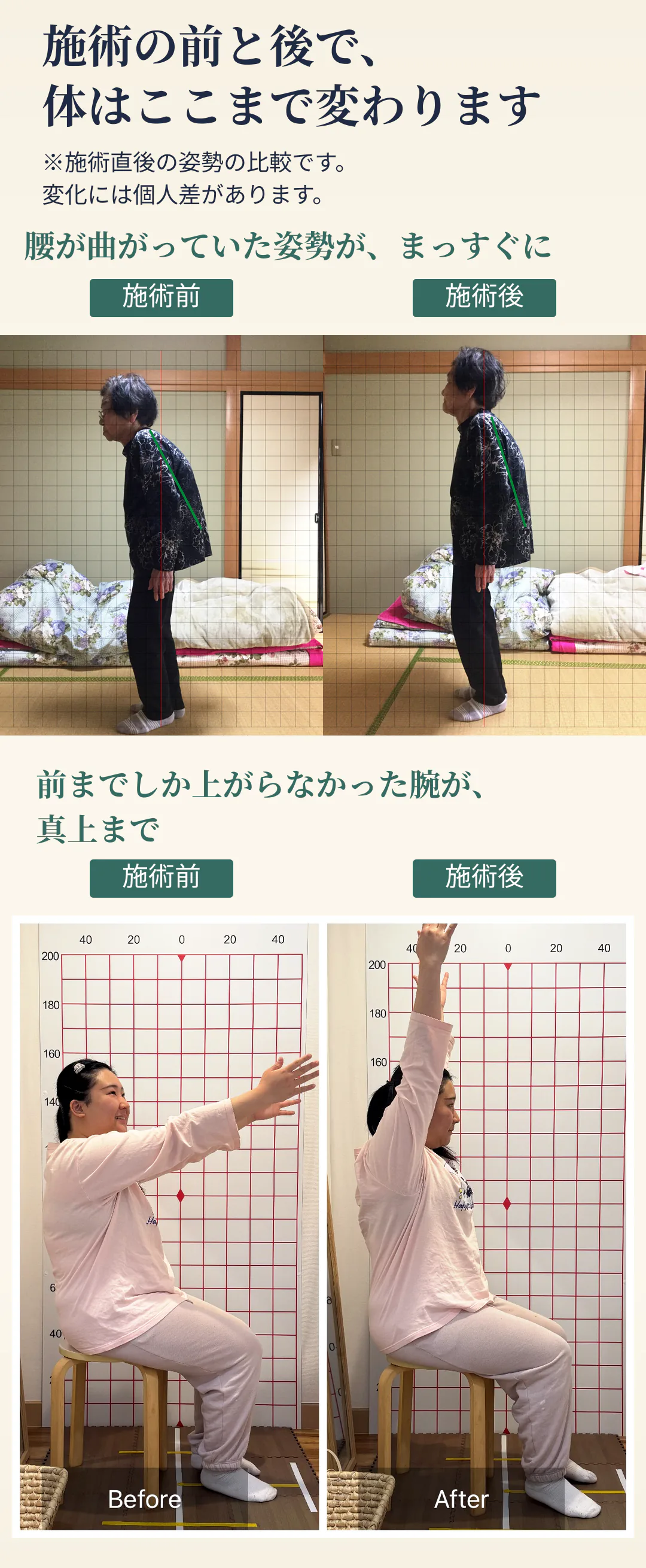 施術の前と後で、体はここまで変わります。※施術直後の姿勢の比較です。変化には個人差があります。施術前／施術後。腰が曲がっていた姿勢が、まっすぐに。前までしか上がらなかった腕が、真上まで。最初の姿勢比較の首の付け根から腰の後ろへ、緑の補助線。
